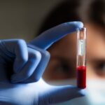 Cancer du sein : il optimise la radiothérapie, ce qu’il faut savoir sur Rila Breast, le test de tolérance inventé à Montpellier