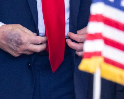 Des ecchymoses sur la main de Donald Trump ravivent les inquiétudes sur sa santé lors de sa rencontre avec le président sud-coréen