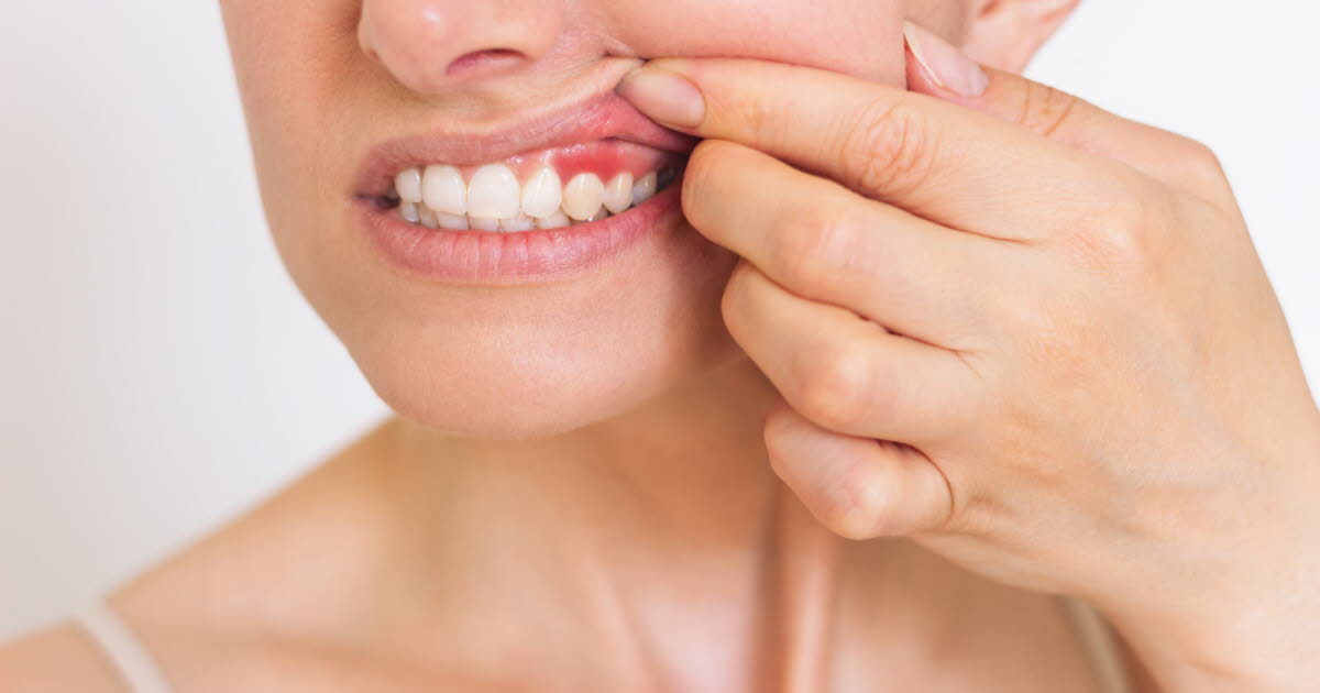 L'importance de maintenir la santé des gencives en cas de gingivite