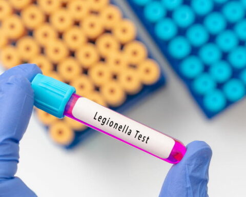 Alerte à la légionellose à Albertville : cinq points clés sur cette infection grave