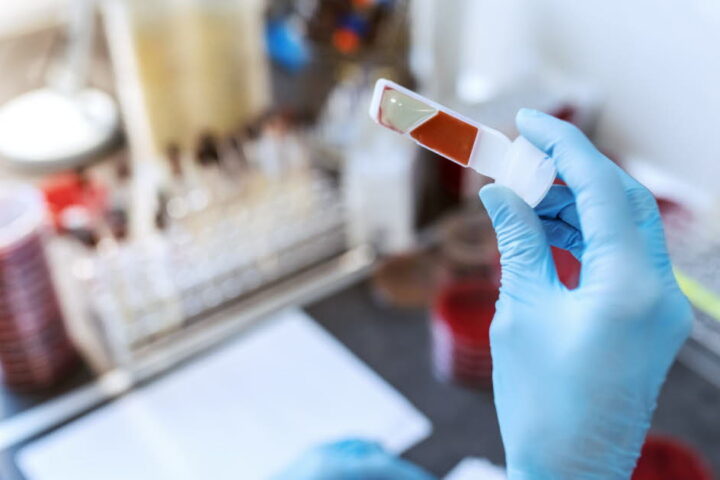 Décès de Rick Davies, cofondateur de Supertramp, des suites d'un myélome multiple