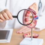 Dépistage de la maladie rénale : pourquoi il est crucial même sans symptômes