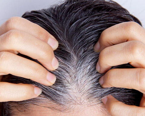 Le blanchiment soudain des cheveux : mythe ou réalité liée au stress ?