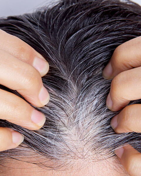 Le blanchiment soudain des cheveux : mythe ou réalité liée au stress ?