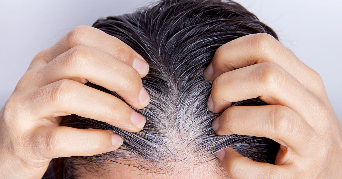 Le blanchiment soudain des cheveux : mythe ou réalité liée au stress ?