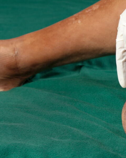 Le cerveau et les membres fantômes : une étude révèle le traitement des sensations après une amputation