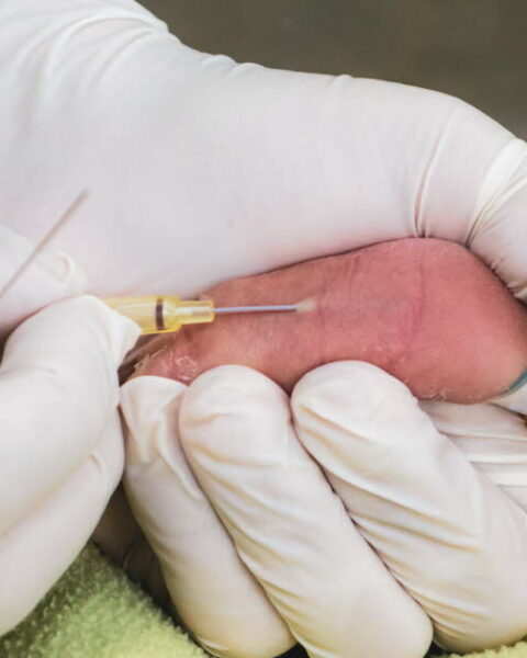 Dépistage néonatal : deux nouvelles maladies recommandées par la HAS pour protection des enfants