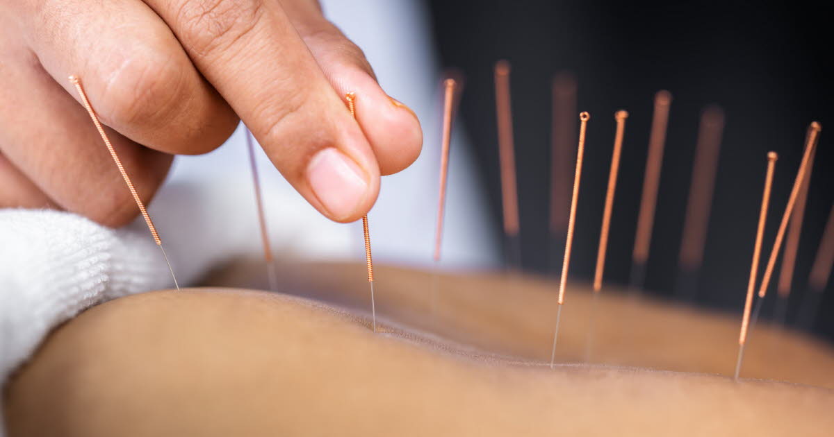 L'acupuncture : un champ d'études cliniques contesté par la médecine conventionnelle en France