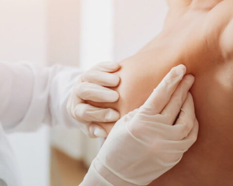 Une étude révèle une augmentation inquiétante des cancers du sein chez les jeunes femmes en France