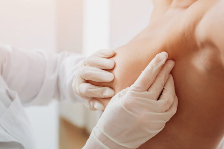 Une étude révèle une augmentation inquiétante des cancers du sein chez les jeunes femmes en France