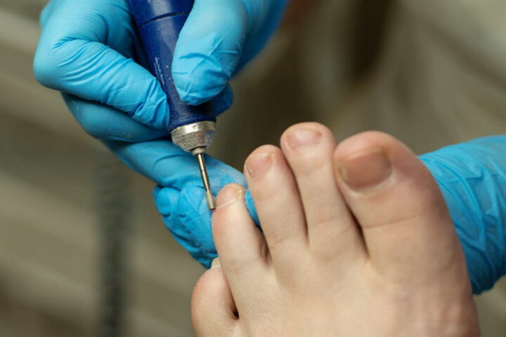 Le radon, un risque sous-estimé pour le cancer du poumon en France, selon l'IRSN