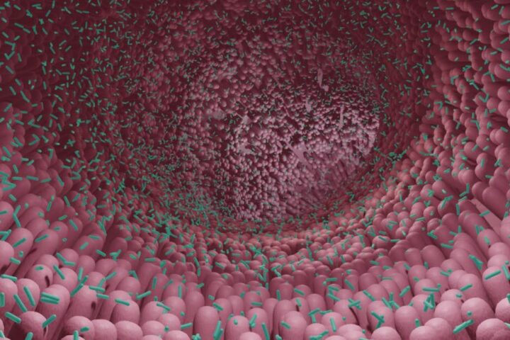 Le rôle crucial de l'alimentation dans le développement du cancer colorectal révélé par une étude