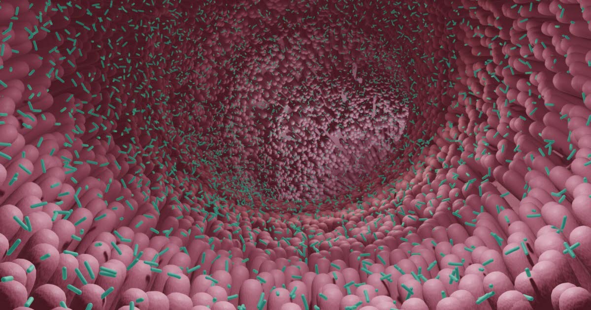 Le rôle crucial de l'alimentation dans le développement du cancer colorectal révélé par une étude