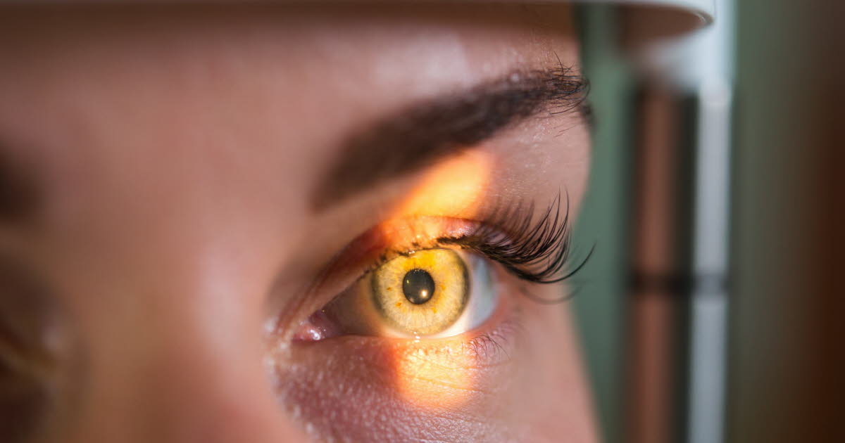 Rétinopathie diabétique : enjeux de santé publique et nécessité d'un dépistage régulier en France