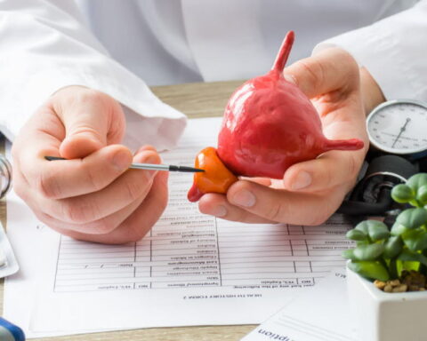 Un nouveau traitement efficace proposé pour les patients en récidive de cancer de la prostate