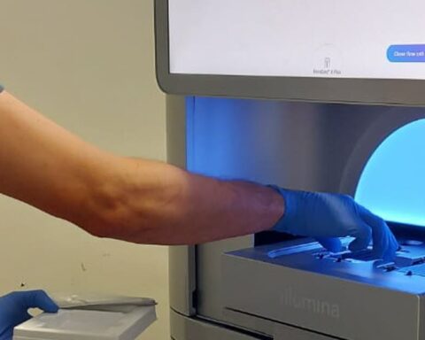 Détection génétique des maladies rares à la naissance : un projet innovant du CHU de Dijon