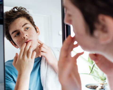La fédération française de la peau présente des brochures éducatives pour sensibiliser les jeunes aux soins dermatologiques
