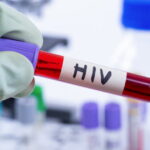 La lutte contre le VIH/sida face à une crise de financement majeure en 2025