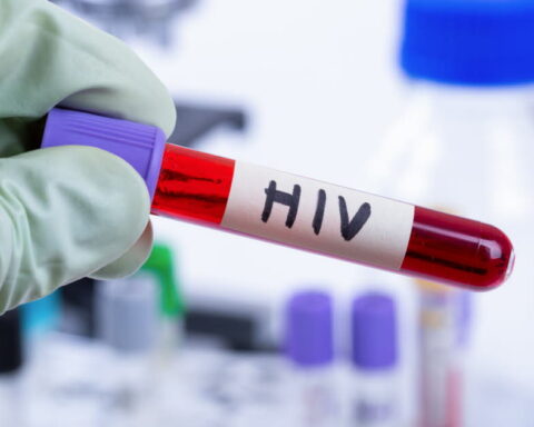 La lutte contre le VIH/sida face à une crise de financement majeure en 2025
