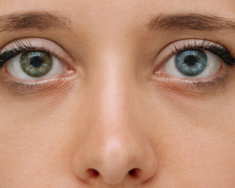 L'hétérochromie : pourquoi certaines personnes ont des yeux de couleurs différentes