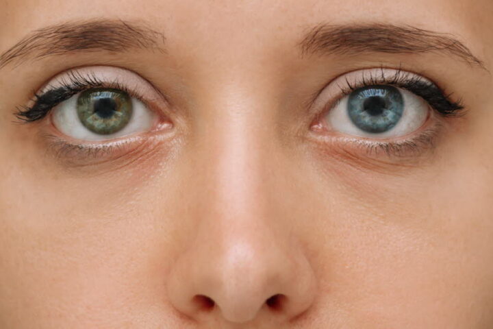 L'hétérochromie : pourquoi certaines personnes ont des yeux de couleurs différentes