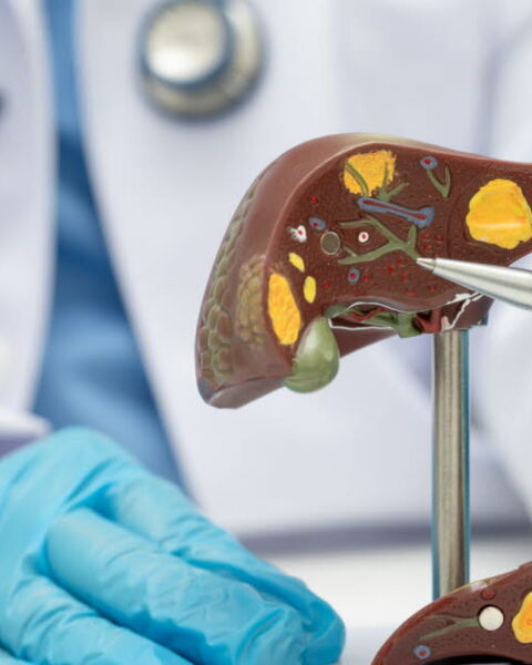 Maladie du foie gras : une pandémie silencieuse préoccupant la santé publique en France