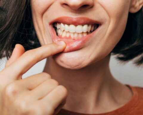 Prendre soin de sa santé bucco-dentaire pour réduire le risque de maladies cardiovasculaires selon l’AHA