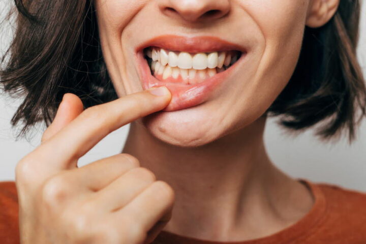 Prendre soin de sa santé bucco-dentaire pour réduire le risque de maladies cardiovasculaires selon l’AHA