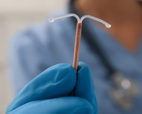 Risque accru de grossesse extra-utérine avec le stérilet hormonal Jaydess, selon une étude