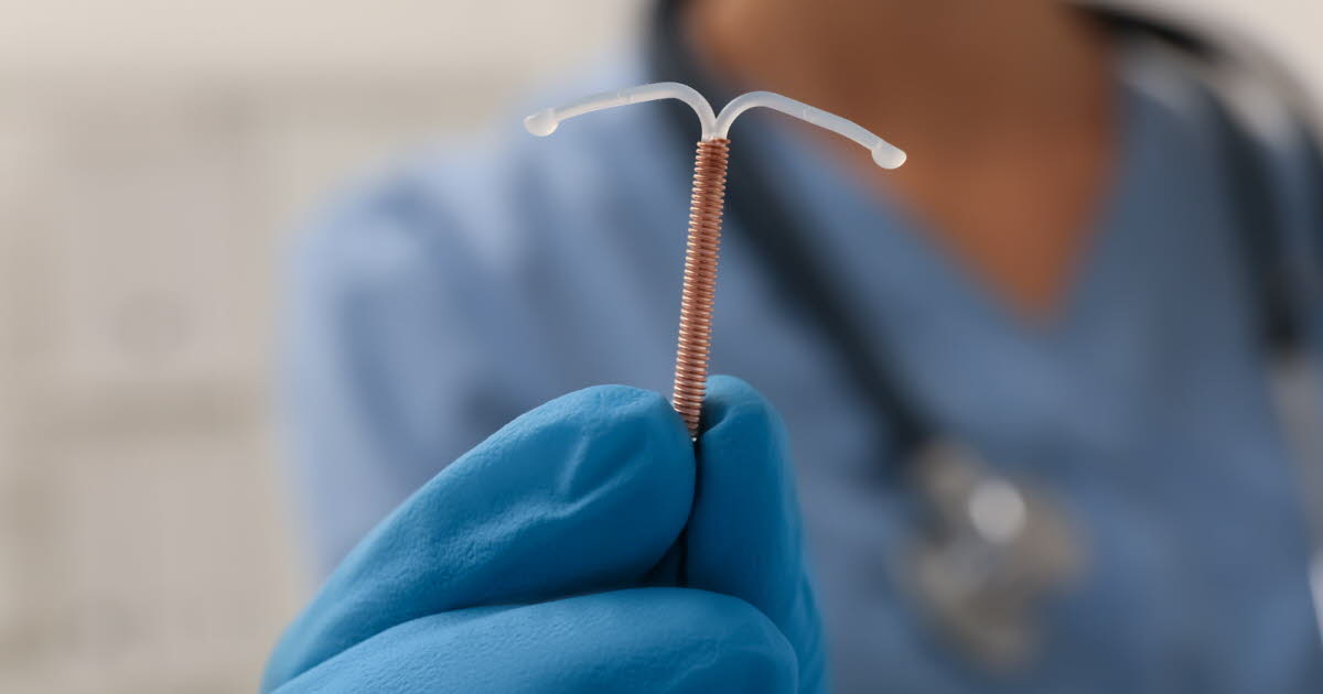 Risque accru de grossesse extra-utérine avec le stérilet hormonal Jaydess, selon une étude