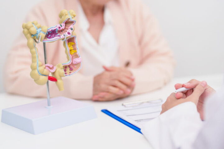 Cancer colorectal : peu de coloscopies réalisées dans les délais après un test positif en France