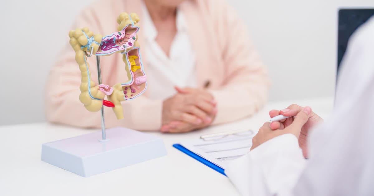 Cancer colorectal : peu de coloscopies réalisées dans les délais après un test positif en France