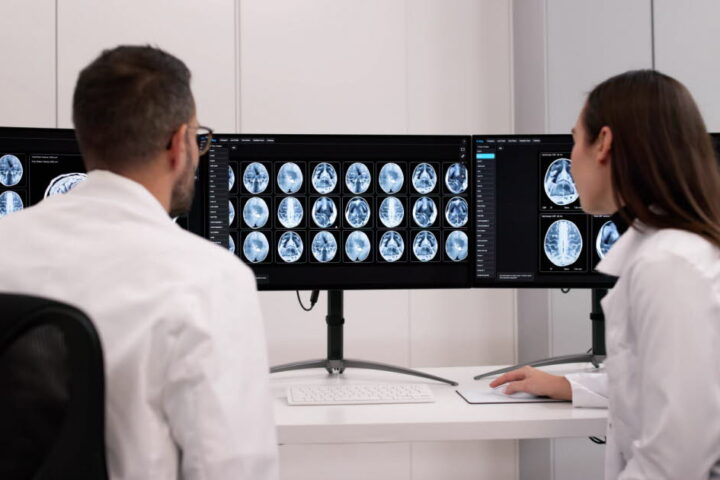 Découverte sur les tanycytes et leur rôle dans l'accumulation de la protéine Tau dans Alzheimer