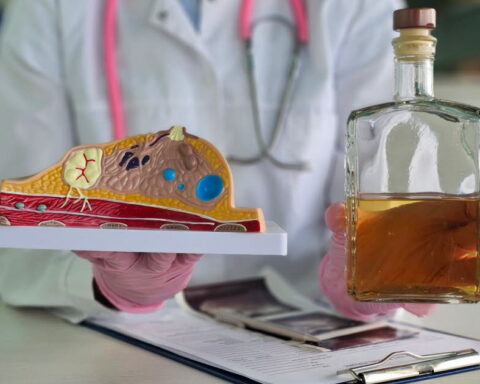 L'alcool et son rôle dans l'augmentation des risques de cancers en France