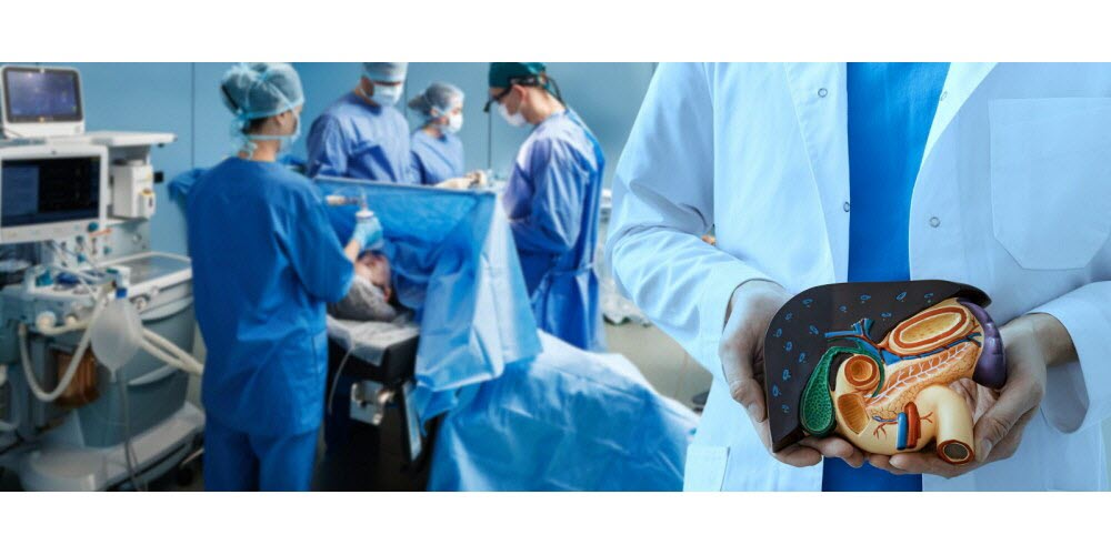 L'augmentation inquiétante des cas de cancer du pancréas en France en 2023