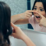 L'isotrétinoïne et la rumeur sur l'affinement du nez : éclairages d'experts sur TikTok