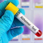 Un test sanguin pourrait prédire le risque de développer la maladie d'Alzheimer jusqu'à 25 ans à l'avance