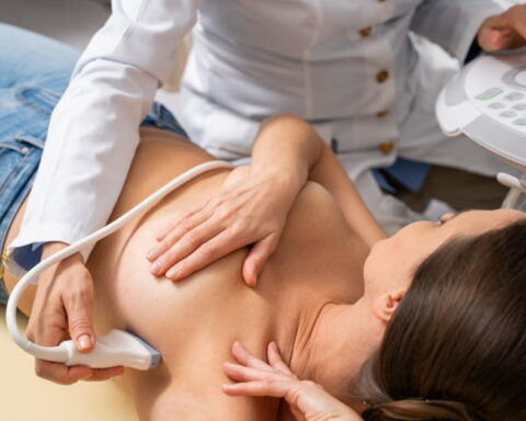 Cancer : l'importance cruciale du ganglion sentinelle dans le diagnostic précoce