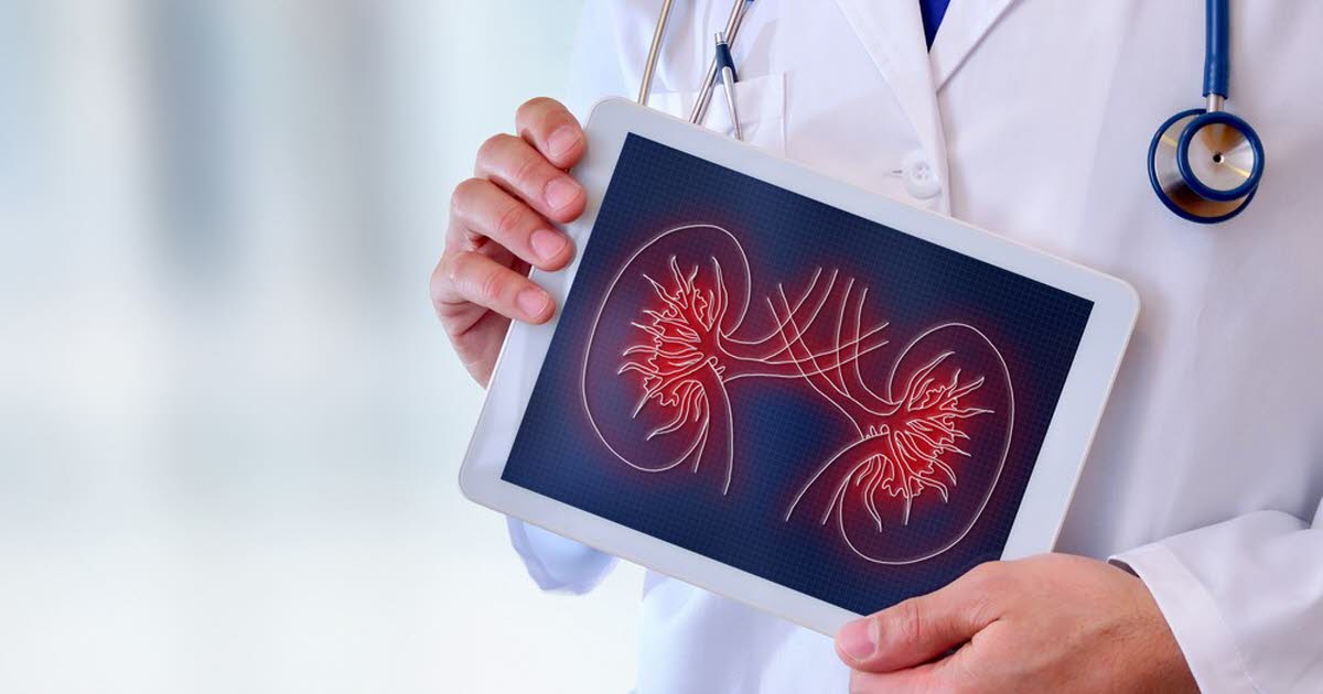 Des chercheurs identifient une protéine clé dans la progression des maladies rénales chroniques