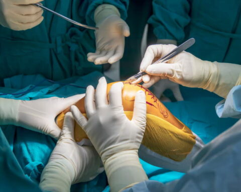 Chirurgie du genou : la méniscectomie partielle jugée inefficace et nocive selon des chercheurs finlandais