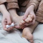 Mycose des ongles : cinq questions pour mieux comprendre l'onychomycose