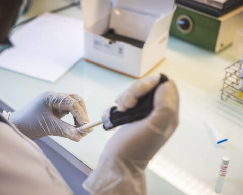 Un test de dépistage du cadmium bientôt remboursé pour les populations à risque en France