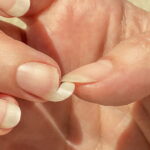 Causes des ongles cassants et solutions efficaces pour les traiter