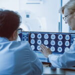 La stimulation cérébrale profonde : une avancée en psychiatrie et neurologie pour traiter diverses pathologies