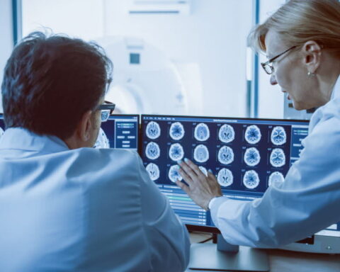 La stimulation cérébrale profonde : une avancée en psychiatrie et neurologie pour traiter diverses pathologies