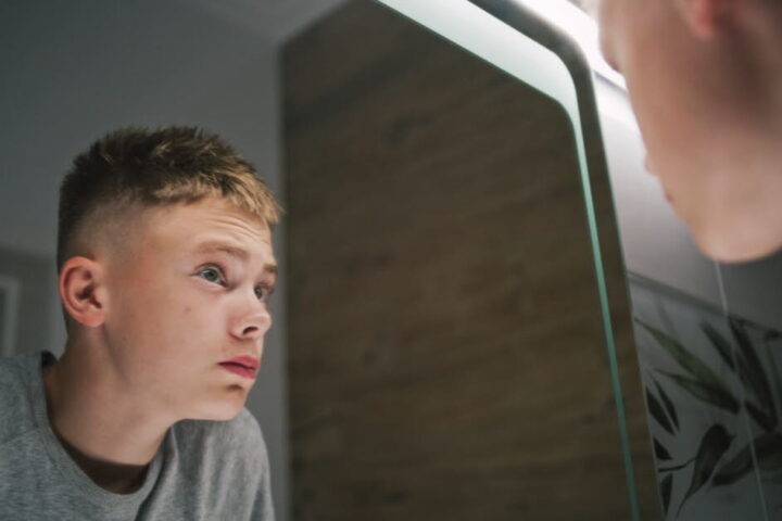 Le bone smashing : une pratique dangereuse pour améliorer son apparence chez les adolescents