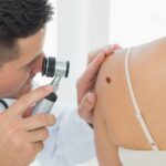 Un prototype de tatouage intelligent pour détecter précocement le cancer de la peau
