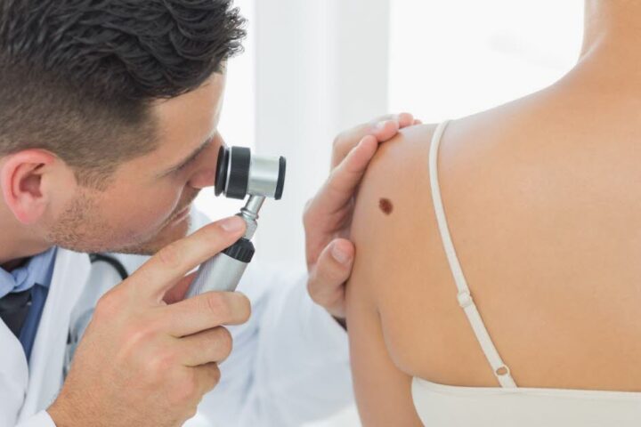 Un prototype de tatouage intelligent pour détecter précocement le cancer de la peau
