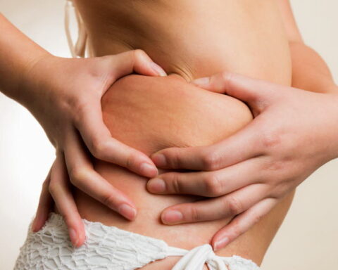 Accepter son corps en maillot de bain : conseils pour se libérer des complexes