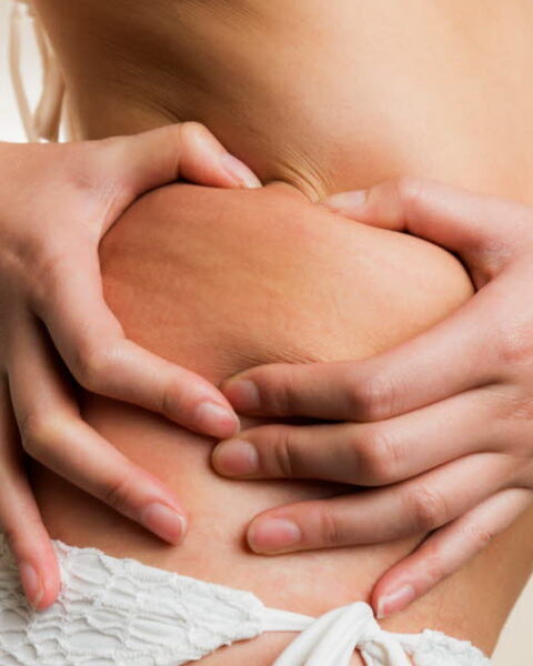 Accepter son corps en maillot de bain : conseils pour se libérer des complexes